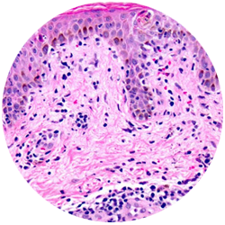 Dermato-patologija